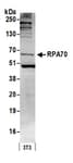 Detection of mouse RPA70 by western blot.