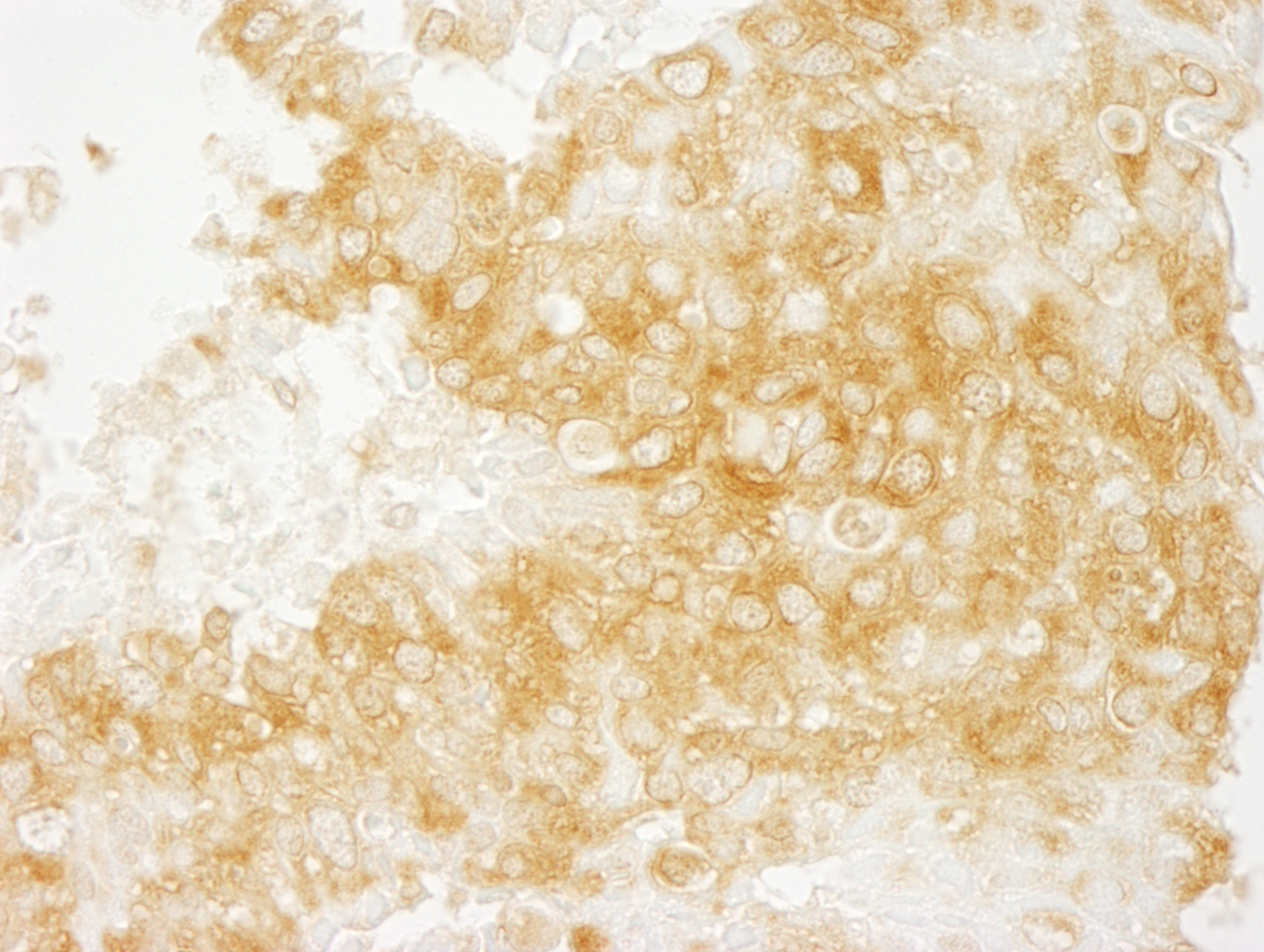 Rabbit anti-Diaphanous 1 Antibody Affinity Purified, image 3