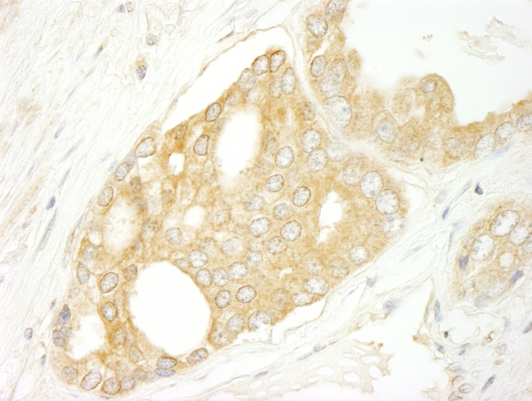 Rabbit anti-BRAF IHC Antibody