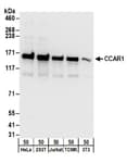 Detection of human and mouse CCAR1 by western blot.