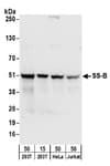 Detection of human SS-B by western blot.