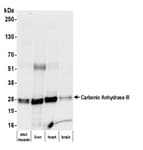 Detection of mouse Carbonic Anhydrase III by western blot.