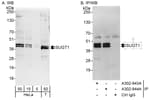 Detection of human SUGT1 by western blot and immunoprecipitation.