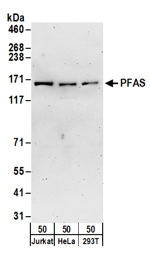Detection of human PFAS by western blot.