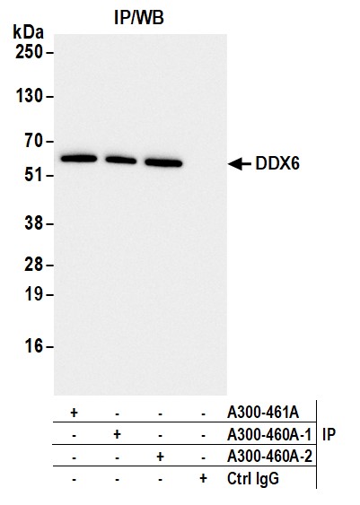 Detection of human DDX6 by western blot of immunoprecipitates.