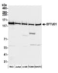 Detection of human and mouse EFTUD1 by western blot.