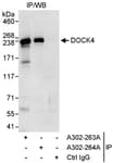Detection of human DOCK4 by western blot of immunoprecipitates.