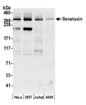 Detection of human Senataxin by western blot.
