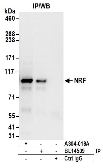 Detection of human NRF by western blot of immunoprecipitates.
