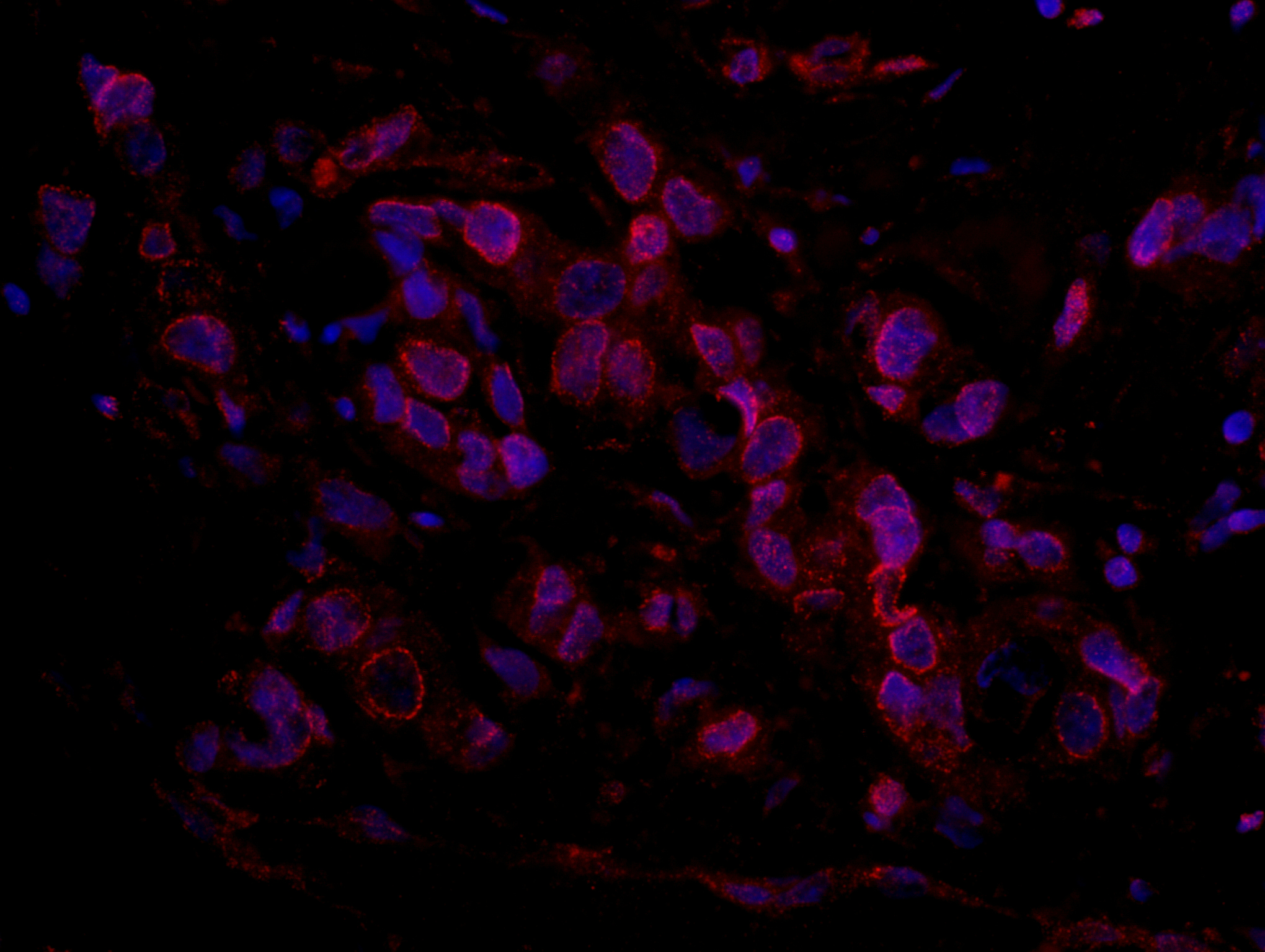 Rabbit anti-ARID4B IHC Antibody