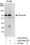 Detection of human Synoviolin by western blot of immunoprecipitates.