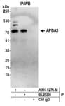 Detection of human APBA3 by western blot of immunoprecipitates.