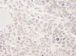 Detection of mouse SKIV2L2 by immunohistochemistry.