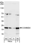Detection of human COMMD4 by western blot.