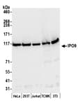 Detection of human and mouse IPO9 by western blot.