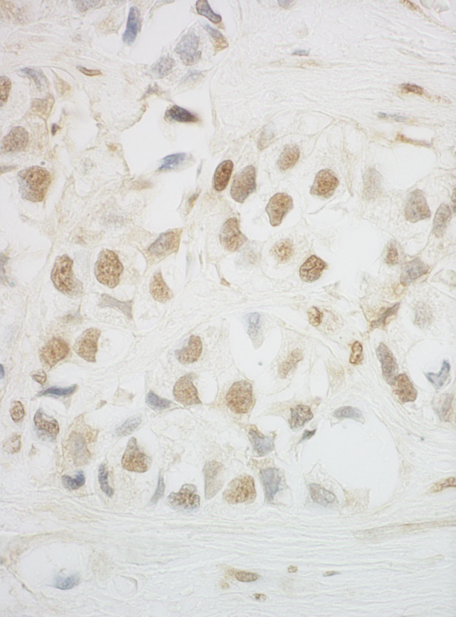 Rabbit anti-HCA66 IHC Antibody