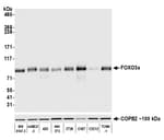 Detection of mouse FOXO3a by western blot.