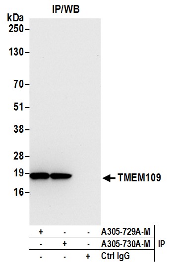 Detection of human TMEM109 by western blot of immunoprecipitates.