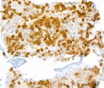 Detection of mouse Ly-6G in mouse bone marrow by IHC.
