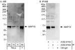 Detection of human MAP1S by western blot and immunoprecipitation.