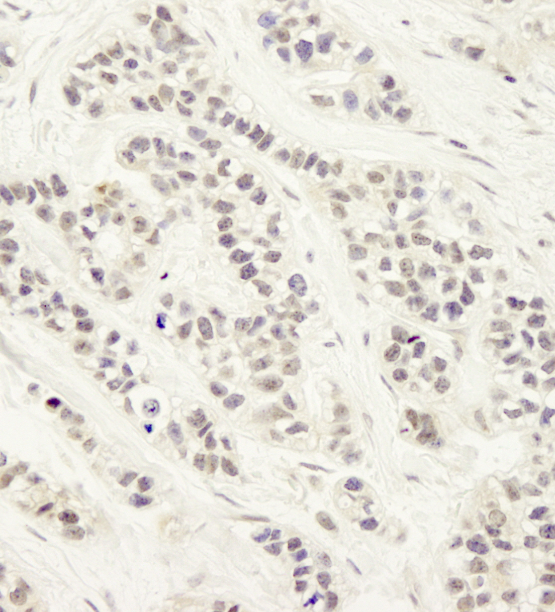 Rabbit anti-Artemis IHC Antibody