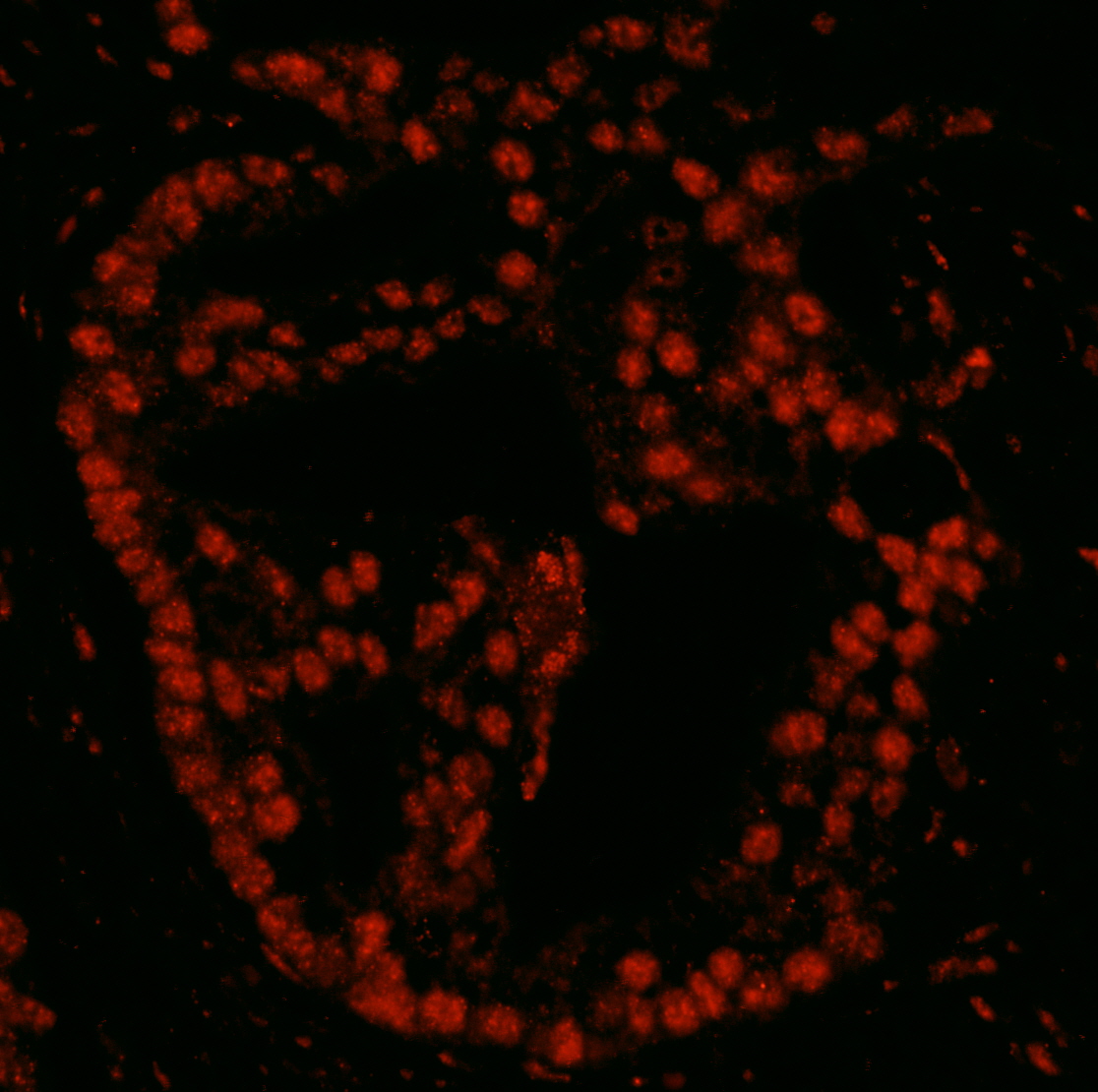 Detection of human Pds5B by IHC-IF.