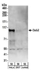 Detection of human Dab2 by western blot.