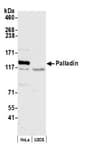 Detection of human Palladin by western blot.