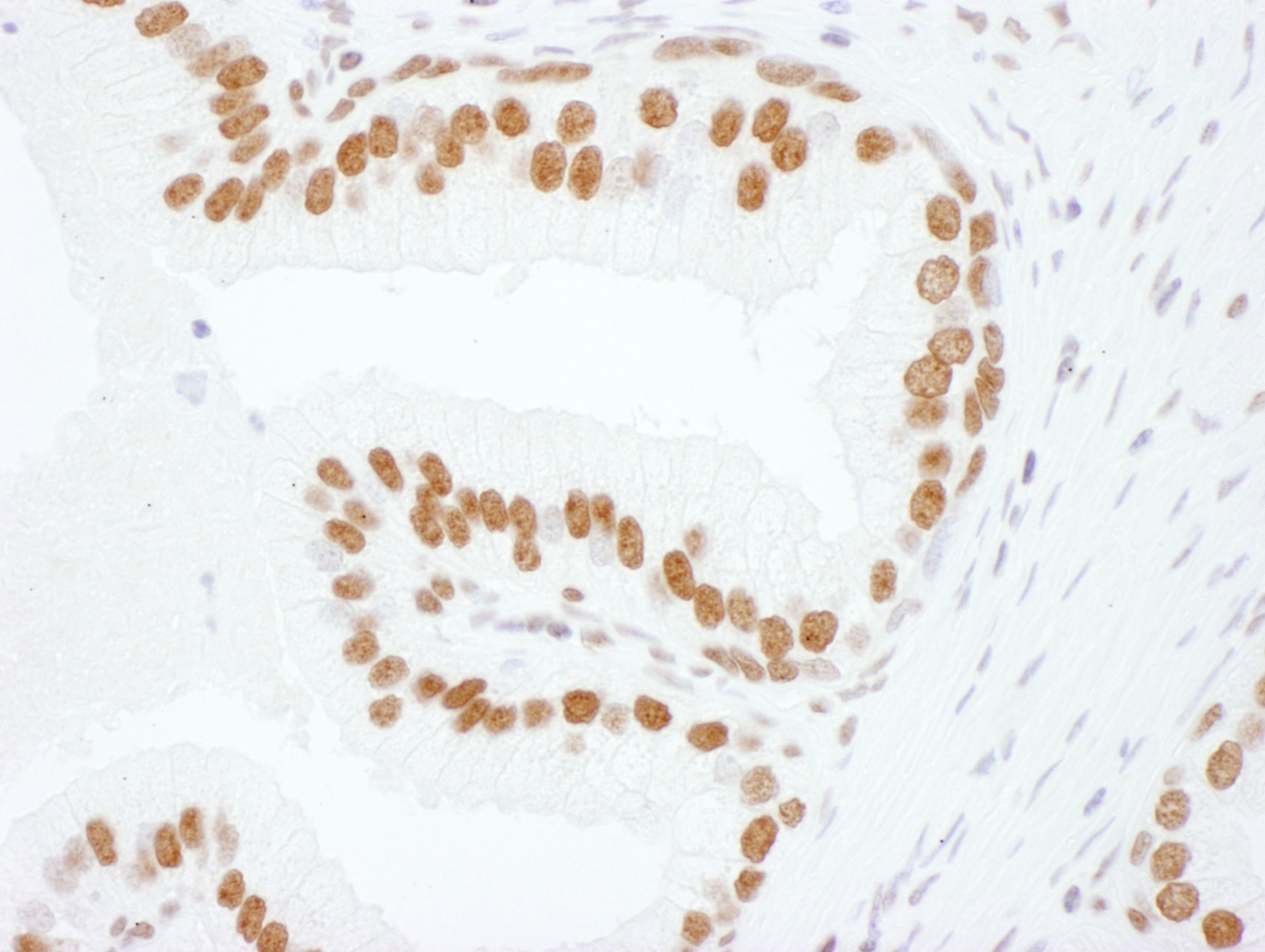 Detection of human hnRNP-L by immunohistochemistry.