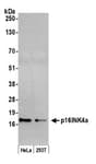 Detection of human p16INK4a by western blot.