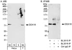 Detection of human DDX18 by western blot and immunoprecipitation.