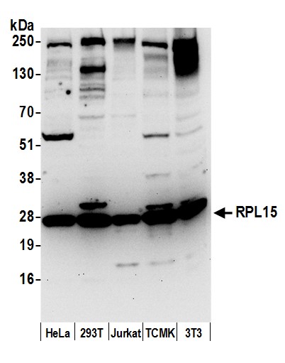 TRPM7 (L15) Rabbit mAb