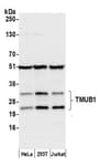 Detection of human TMUB1 by western blot.
