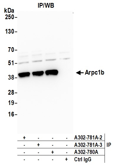 Detection of human Arpc1b by western blot of immunoprecipitates.