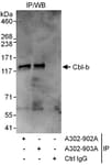 Detection of human Cbl-b by western blot of immunoprecipitates.