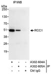 Detection of human RCC1 by western blot of immunoprecipitates.