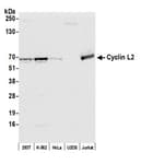 Detection of human Cyclin L2 by western blot.