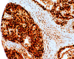 Detection of human PCNA by immunohistochemistry.