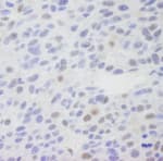 Detection of mouse MED1 by immunohistochemistry.