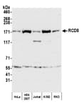 Detection of human RCD8 by western blot.