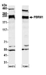 Detection of mouse PBRM1 by western blot.