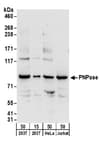 Detection of human PNPase by western blot.