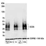 Detection of human ICOS by western blot.