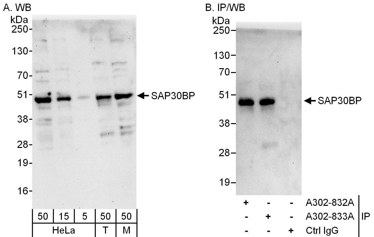 Detection of human and mouse SAP30BP by western blot (h&amp;m) and immunoprecipitation (h).