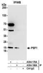 Detection of human PSF1 by western blot of immunoprecipitates.