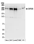 Detection of human and mouse DIP2B by western blot.