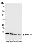 Detection of human and mouse NDUFA5 by western blot.