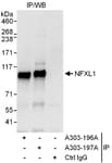 Detection of human NFXL1 by western blot of immunoprecipitates.