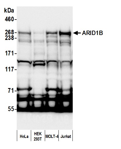 Detection of human ARID1B by western blot.