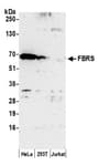 Detection of human FBRS by western blot.